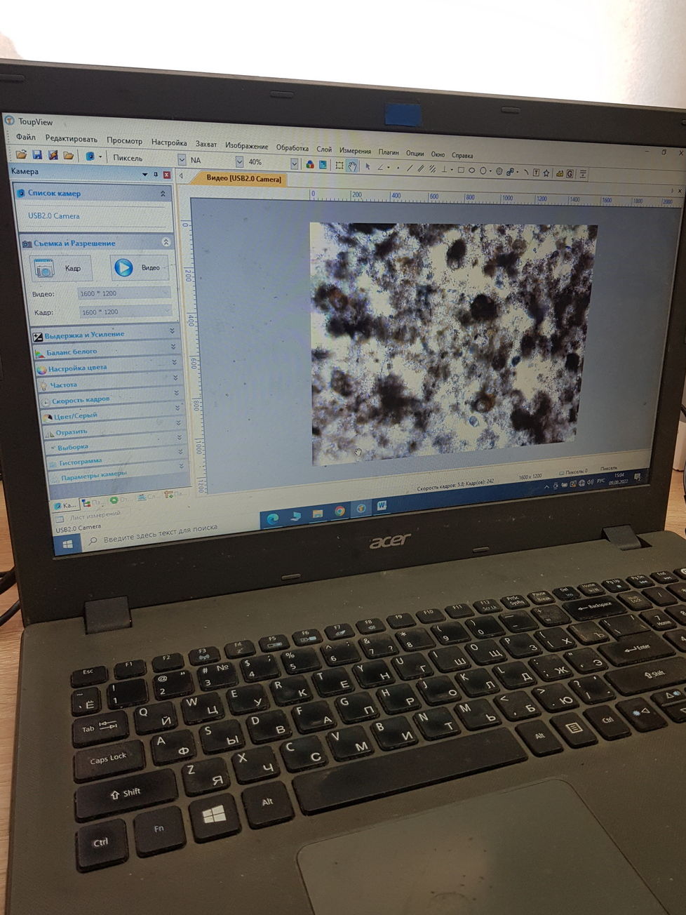 Гидробиологический анализ активного ила