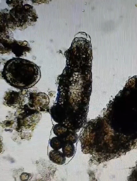 Гидробиологический анализ активного ила