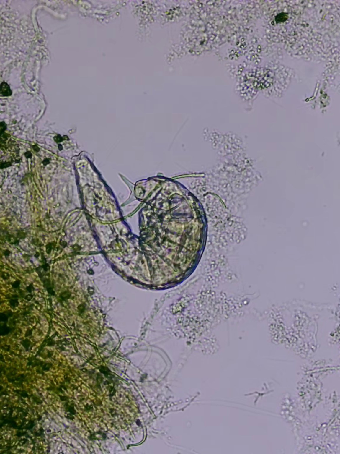 Гидробиологический анализ активного ила