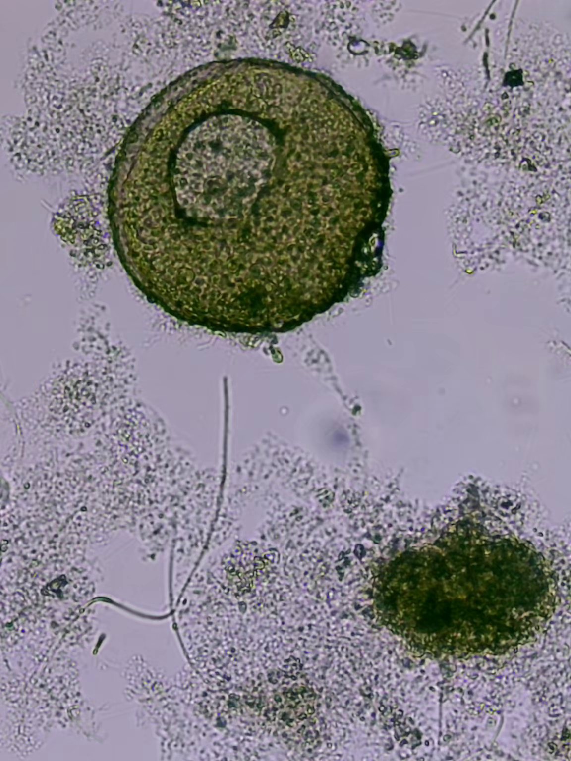 Гидробиологический анализ активного ила