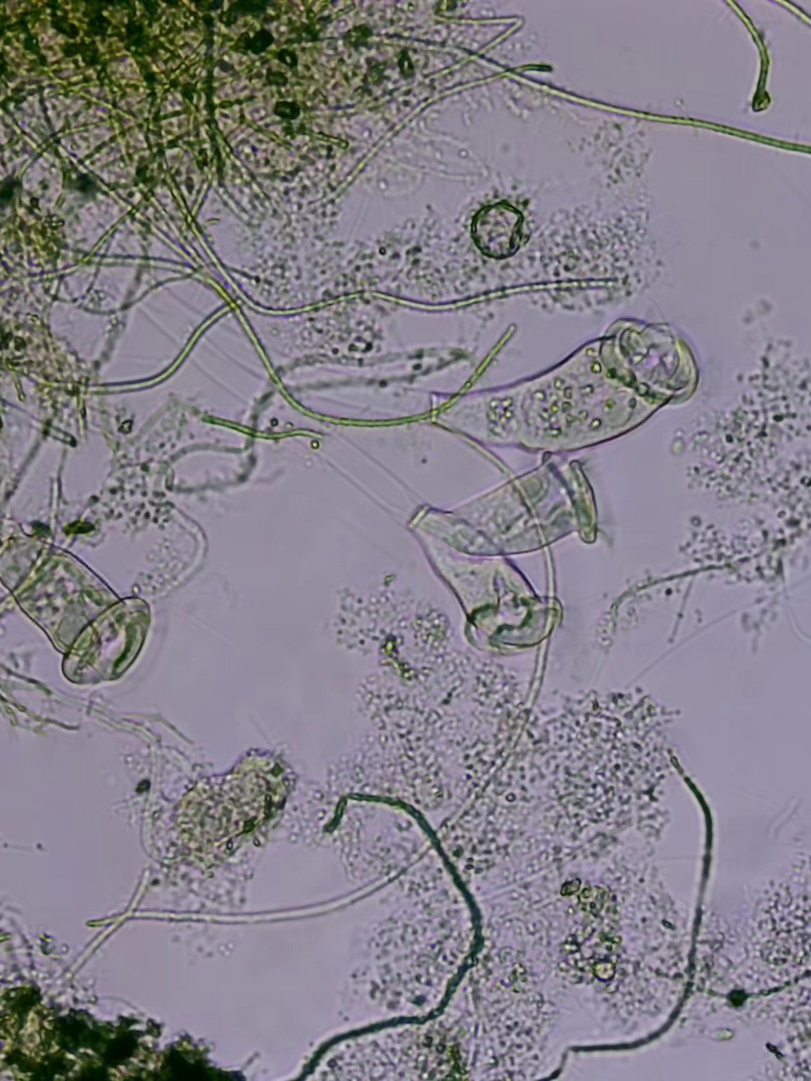 Гидробиологический анализ активного ила